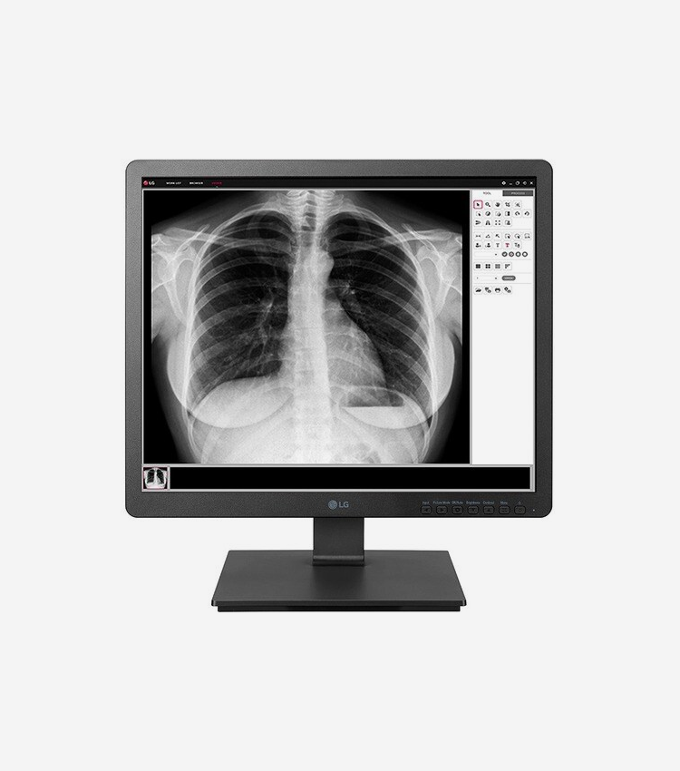 LG 19HK312C-B 19" (482.60 mm) Class SXGA LCD Monitor - 5:4 - Black - 19" (482.60 mm) Viewable - LED Backlight